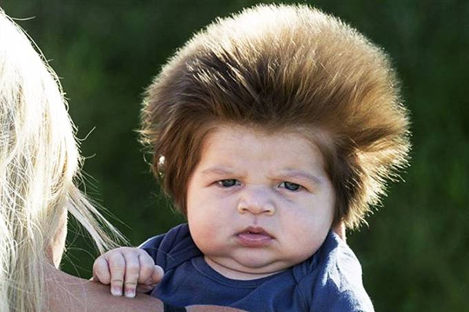 Por que alguns bebês nascem mais cabeludos?