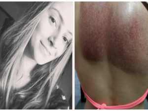 Jovem fica presa no filtro da piscina e desabafa: ‘Achei que fosse morrer’