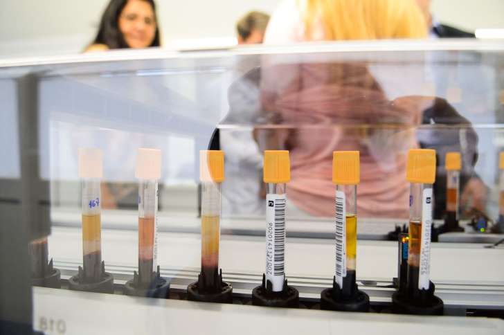 ‘Doença da urina preta’ foi causada pela ingestão de peixe, diz estudo