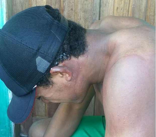 Cacimbinhas: Jovem ateia fogo no próprio corpo em desafio de jogo semelhante ao Baleia Azul