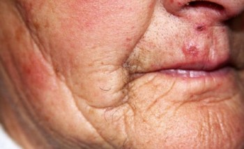 Idosa de 60 anos é estuprada em Garanhuns