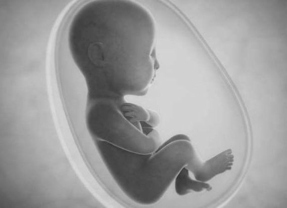 Menino viveu com feto do irmão gêmeo no estômago por 15 anos: entenda caso raro