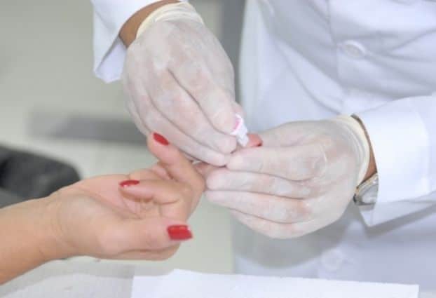 Cai número de mortes por Aids em Alagoas