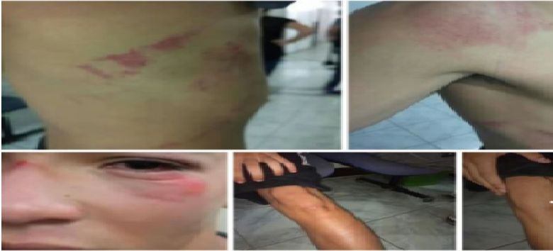 Mulher diz que filho foi espancado por policiais do Bope