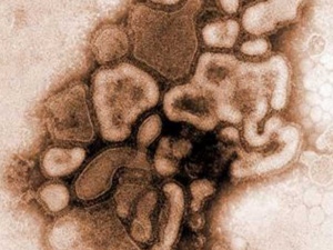 Influenza: Alagoas registra primeira morte pelo vírus H1N1 em 2018