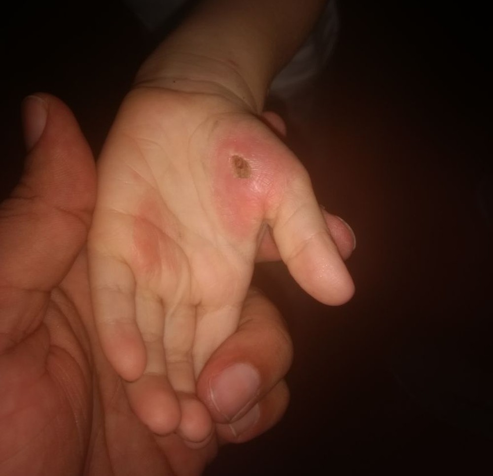 Crianças maltratadas pela mãe são resgatadas pelo Conselho Tutelar em Maceió e Viçosa