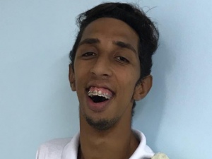 Chamado de ‘monstro’, jovem que não fecha a boca comove especialistas