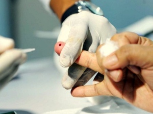 Alagoas notifica 56 casos de hepatite este ano