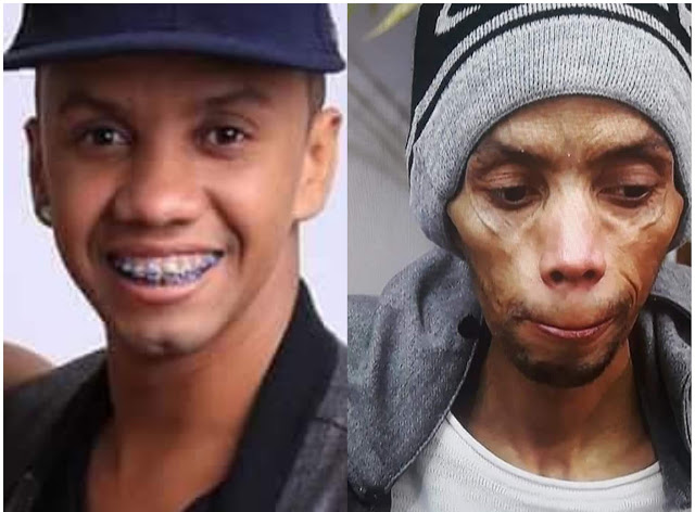 Devinho Novaes e Márcia Fellipe se solidarizam com cantor diagnosticado com câncer