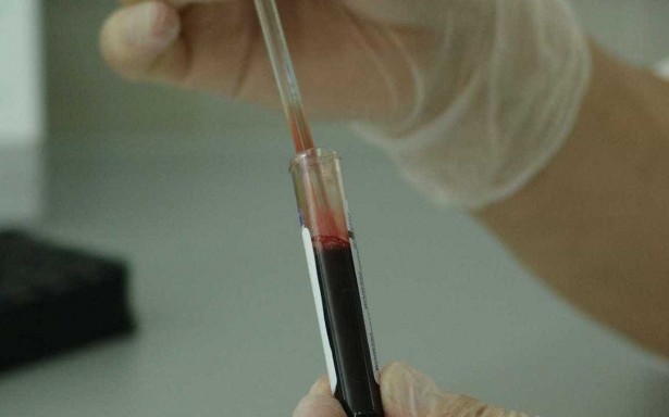 Da epidemia mundial ao tratamento gratuito no Brasil