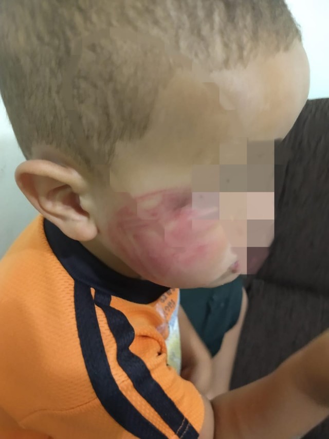 Padrasto é denunciado à polícia por agredir enteado de 3 anos no rosto com sandália, em Teotônio Vilela