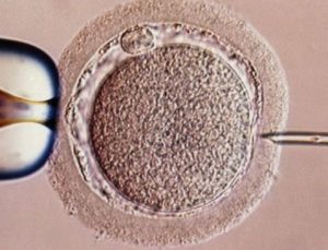 Filho biológico de ‘três pessoas’ nasce na Grécia