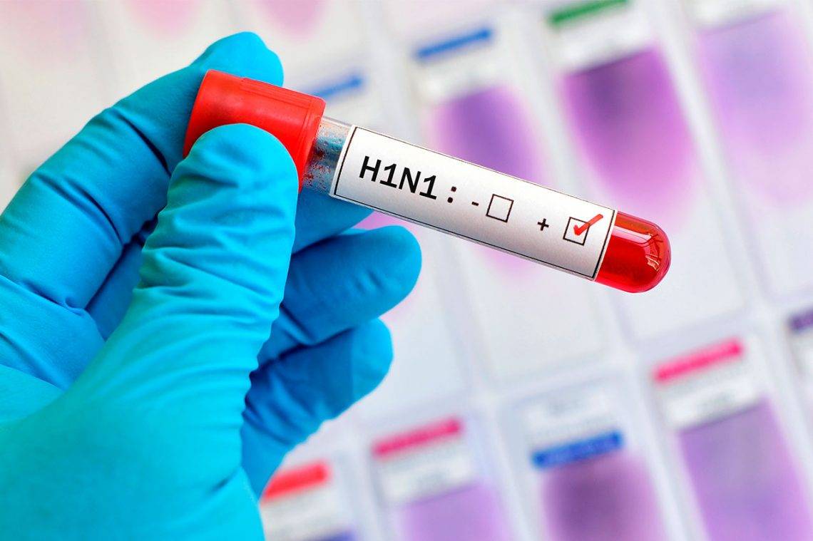 Alerta: Arapiraca registra primeiro caso de H1N1
