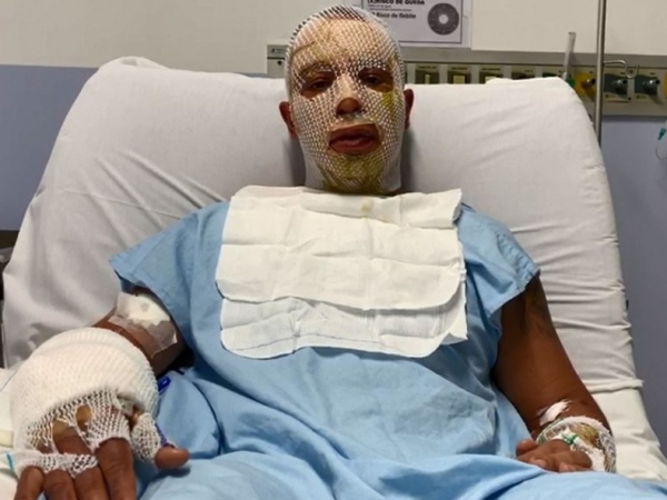 ‘Poderia ter sido fatal’, diz prefeito que sobreviveu com a mulher à explosão