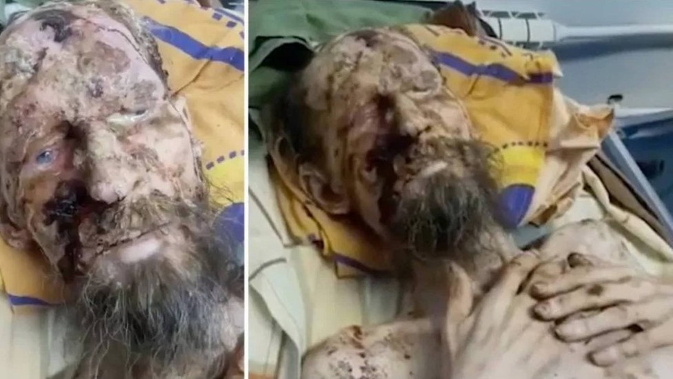 Russo é achado vivo e ‘mumificado’ após um mês mantido ‘refém’ de urso