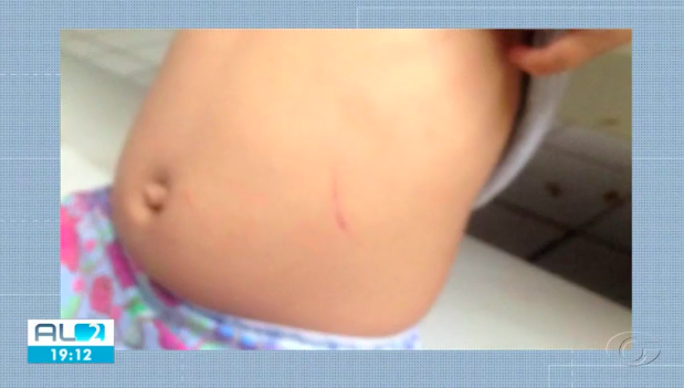 Polícia investiga caso de agressão contra menina de 4 anos em Arapiraca, AL