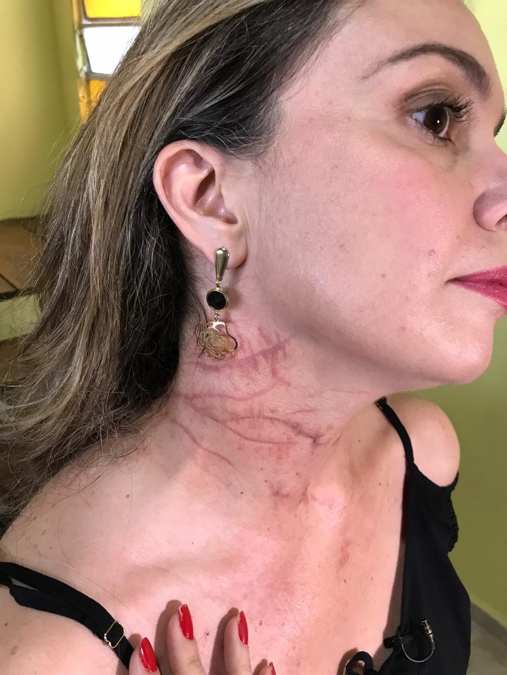 Esfaqueada 70 vezes adverte mulheres: ‘Não há ex-agressor’