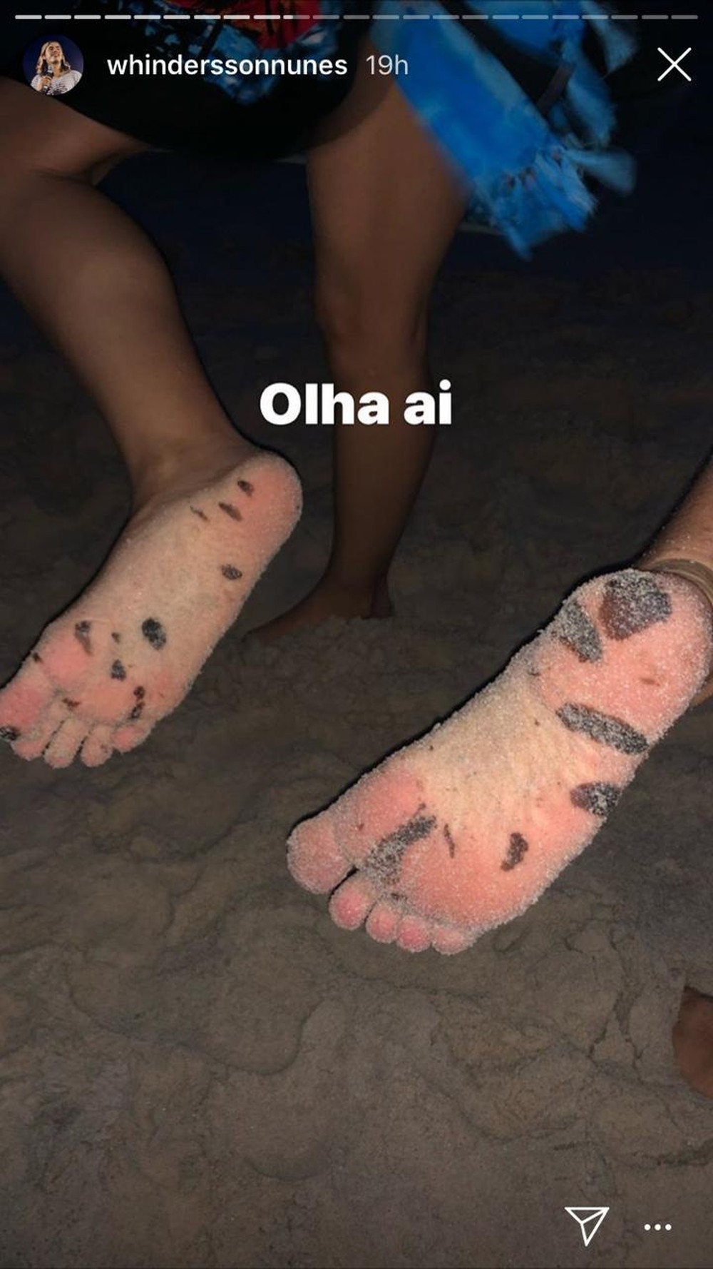 Whindersson Nunes publica foto de pés com manchas de óleo após visita a Alagoas