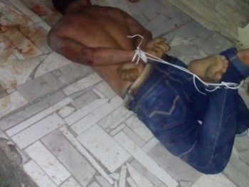 Revoltada, população amarra assaltante com fio e o espanca em Satuba