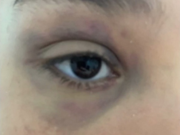 Menina de 14 anos é resgatada após ter sido mantida em cárcere por companheiro