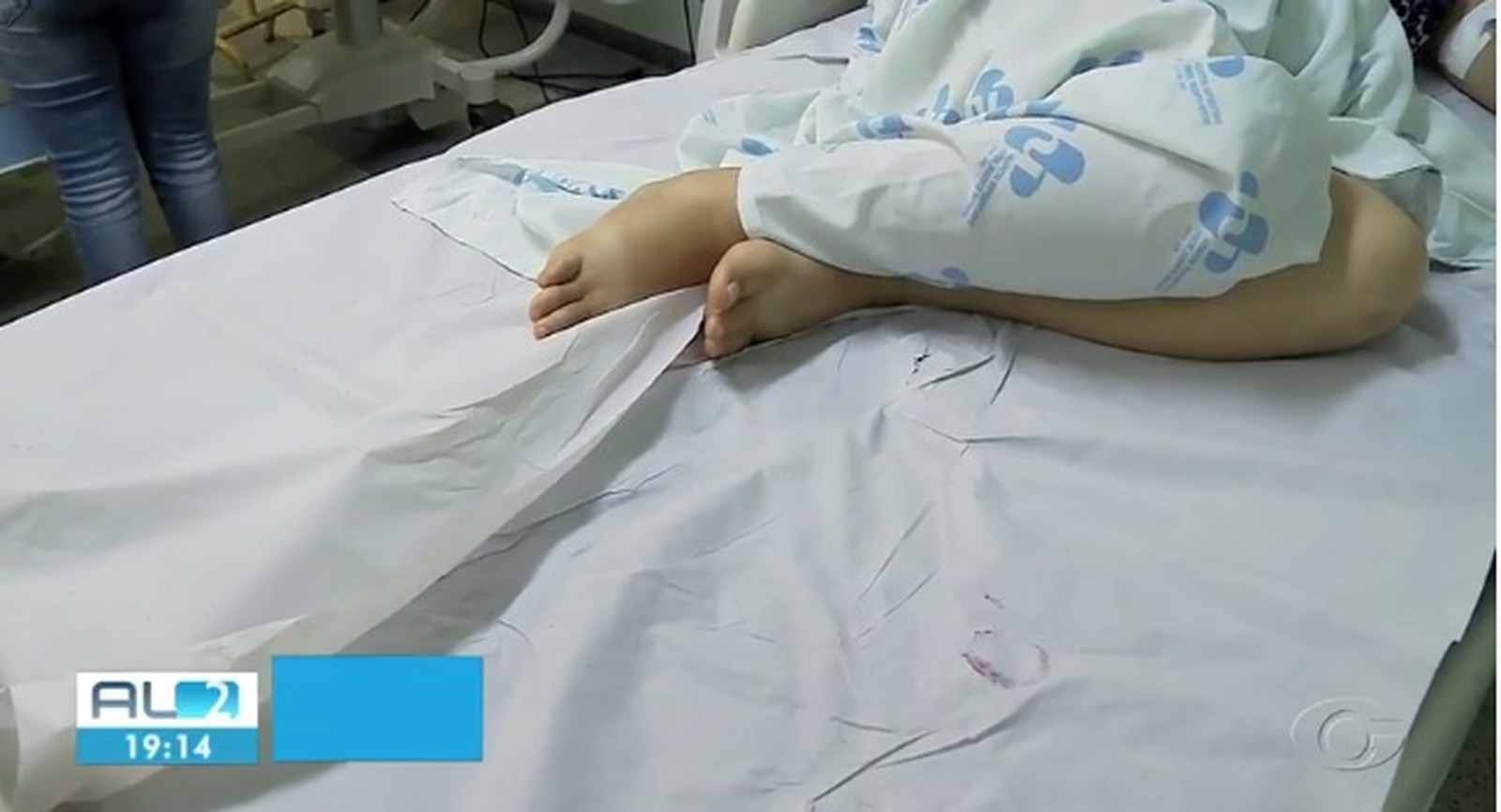 Pacientes com câncer do HU em Maceió deitam em camas forradas com papel