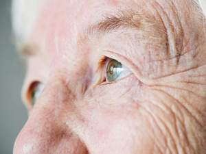 Cirurgia de catarata lidera lista de espera do SUS