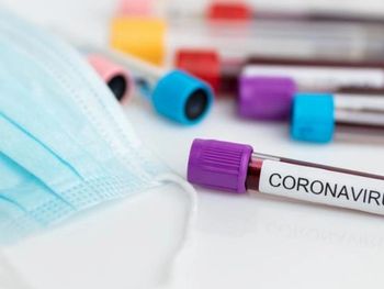 AL: gastos com a pandemia podem ser acessados no Portal da Transparência