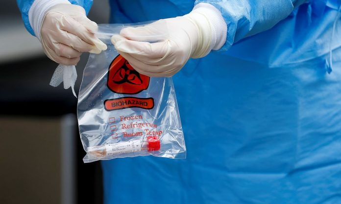 Coronavírus pode ser vencido por sol forte em até 34 minutos, diz estudo