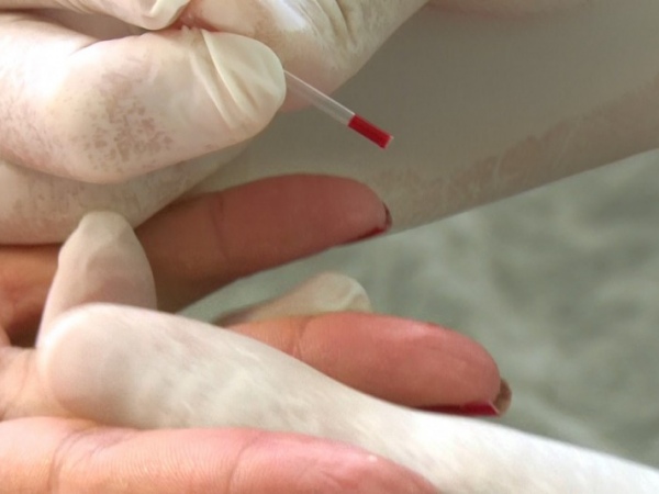 Covid deixa 73 países sob risco de escassez de remédios para Aids