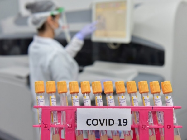 Covid-19: Brasil registra 1.212 óbitos e 52.383 casos nas últimas 24h