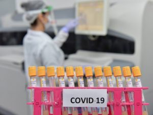 Covid-19: Brasil chega a 2,8 milhões de casos; 70,3% estão recuperados