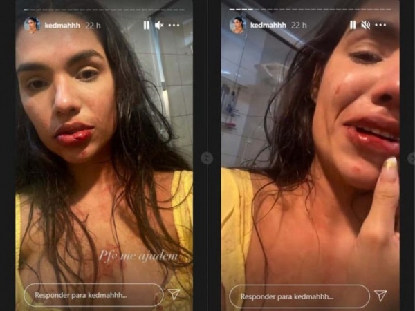 Empresário é preso por agredir influenciadora digital em Florianópolis