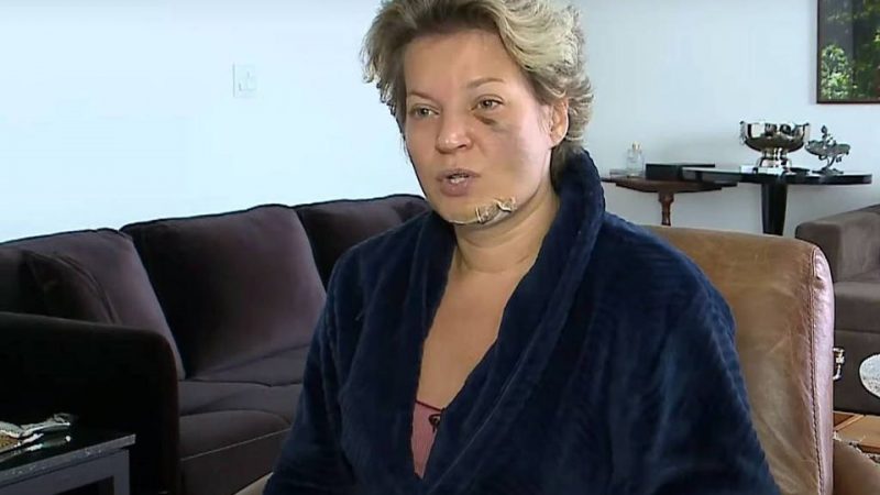 Polícia Legislativa diz que ninguém suspeito entrou na casa de Hasselmann