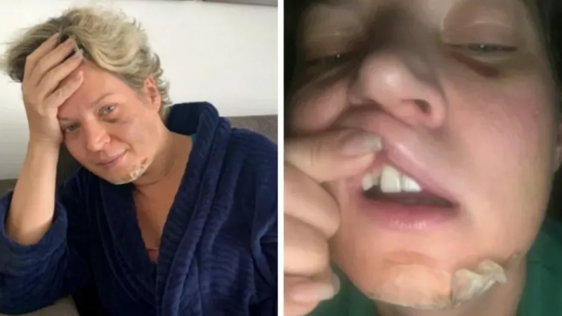 Joice Hasselmann diz que um dos suspeitos de agressão é parlamentar