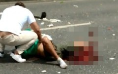 Motoboy tem parte da perna amputada após atropelado por carro na AL-110