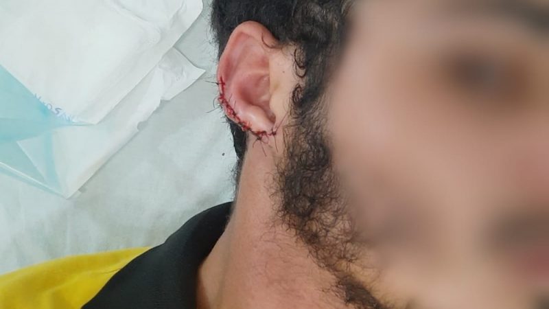 Cliente não paga conta e arranca parte da orelha de funcionário após mordida em São José da Tapera