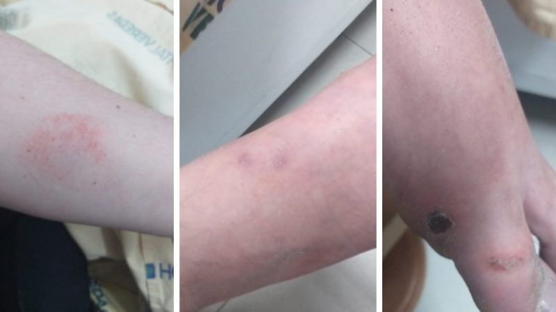 Agressão contra família após show em Jaraguá foi praticada por lutadores de artes maciais, diz PC/AL