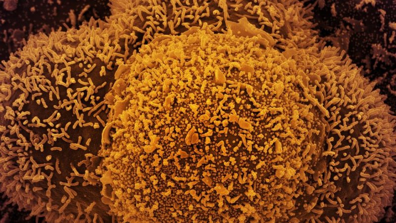 Mundo registra mais de 3 milhões de casos de Covid em 1 dia e bate novo recorde