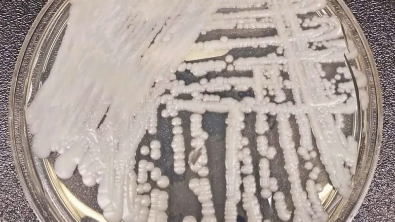 ‘Superfungo’: segundo caso de Candida auris é confirmado em Pernambuco