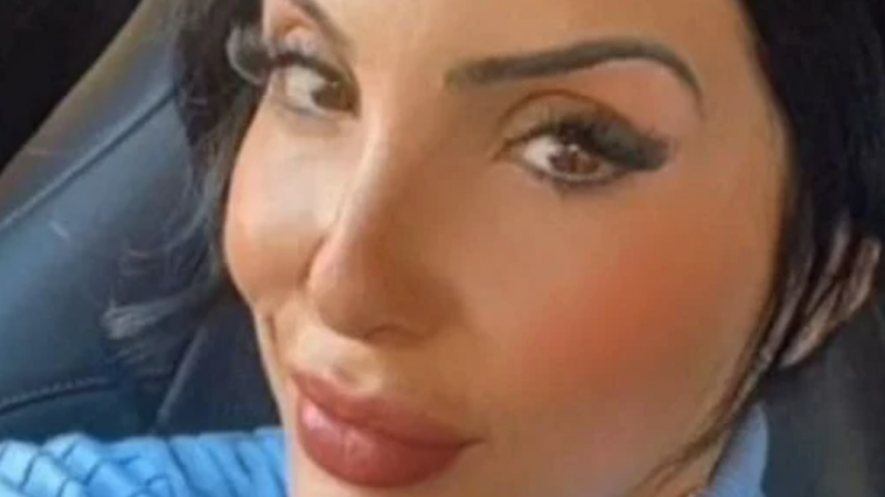 Mulher morre com dezenas de perfurações após cirurgia plástica