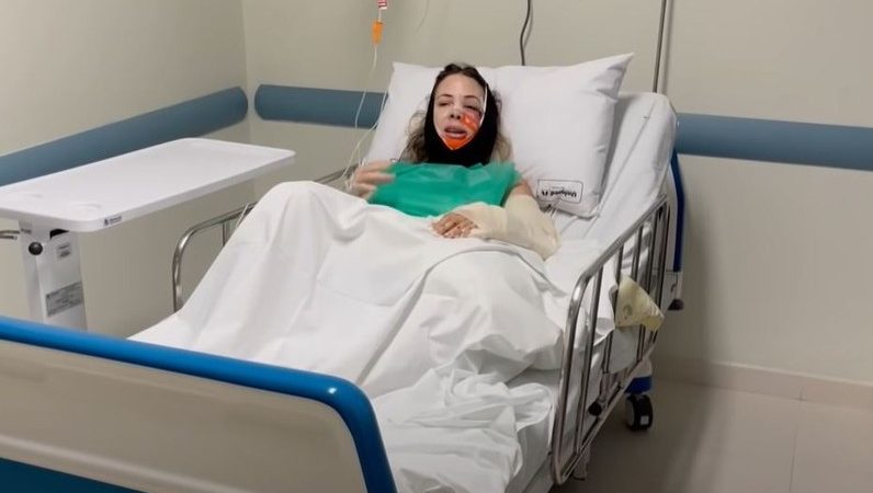 Caminhoneira ‘Musa das Estradas’ mostra rosto reconstruído e relembra acidente: ‘Não senti nada de dor na hora’