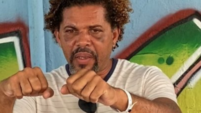 Morador de rua espancado por personal fala pela 1ª vez