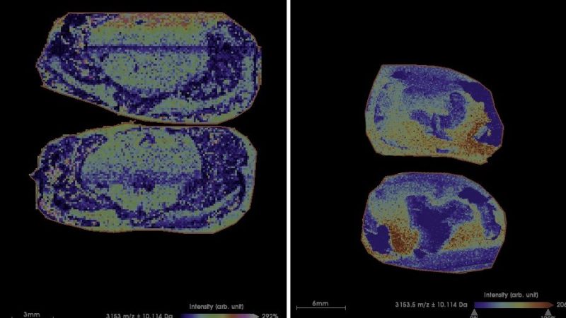 Estudo sugere que pipoca de micro-ondas pode causar danos cerebrais