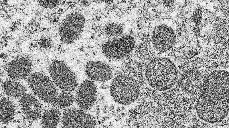 Varíola dos macacos pode ser transmitida pelo ar, alertam cientistas