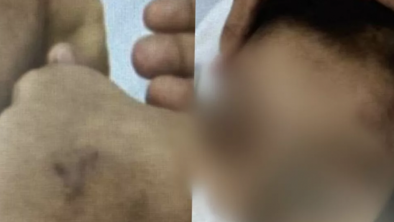 Criança é brutalmente espancada em São Miguel dos Campos, AL; pai e madrasta são presos