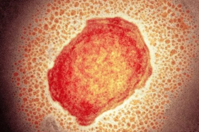 Varíola dos macacos: casos suspeitos em Alagoas são das cidades de Maceió e Rio Largo