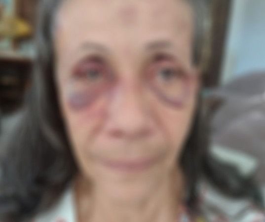 Idosa suspeita de matar o marido diz que agiu em legítima defesa