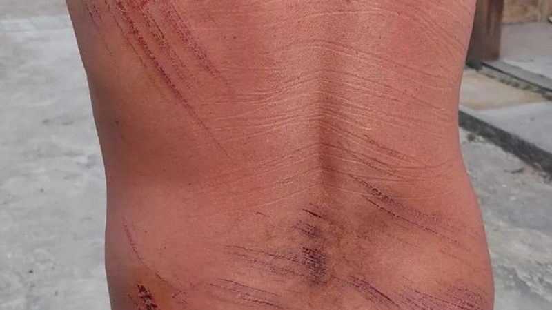 Jardineiro foi arrastado para ilha no RJ e sobreviveu comendo limões e e carvão por 5 dias