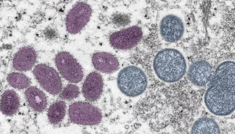 Sobe para 19 o número de casos suspeitos de varíola dos macacos em Alagoas