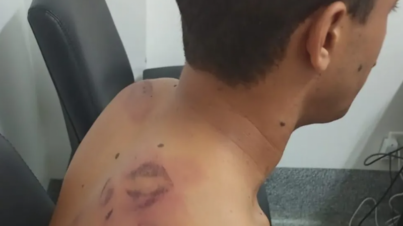 Casal denuncia que teve casa invadida e que foi agredido por PMs em Maceió